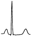 EKG